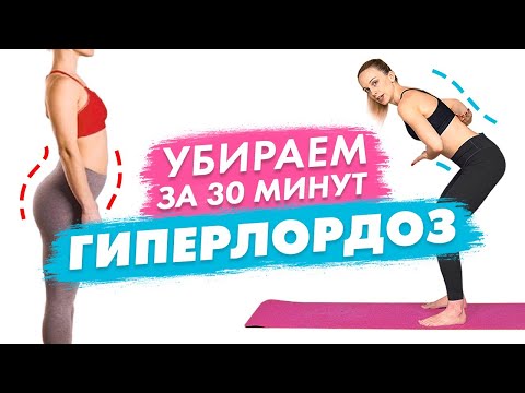 Видео: Как исправить ГИПЕРЛОРДОЗ | Полноценная Тренировка для Красивой ОСАНКИ при Гиперлордозе за 30 минут