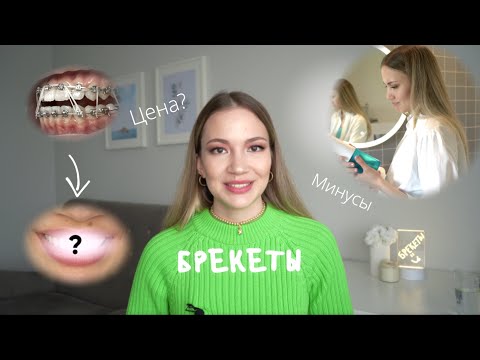 Видео: БРЕКЕТЫ, ПОКА 👋🏻 ДО/ПОСЛЕ,  МИНУСЫ, ЧТО ПОШЛО НЕ ТАК? 🤓 ЗАБАВНЫЕ ИСТОРИИ 😂