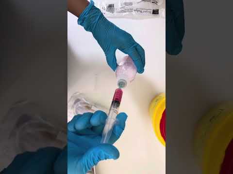 Видео: Системаны дұрыс салу/ Техника правильной постановки капельницы