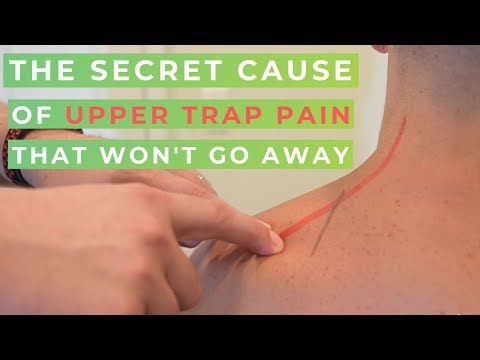 Видео: Боль в верхней части трапеции? Секретная причина, по которой вы не можете опустить плечи