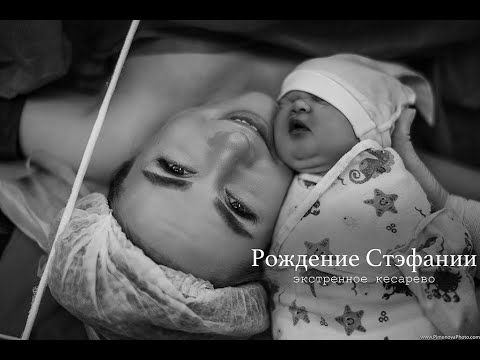 Видео: Рождение Стэфании: третьи роды и ЭКС