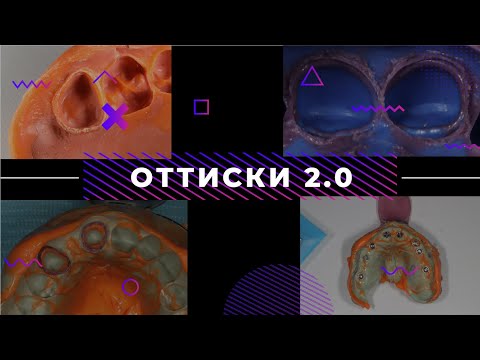Видео: ОТТИСКИ 2.0 ортопедическая стоматология