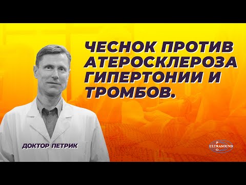 Видео: Чеснок против атеросклероза, гипертонии и тромбов.