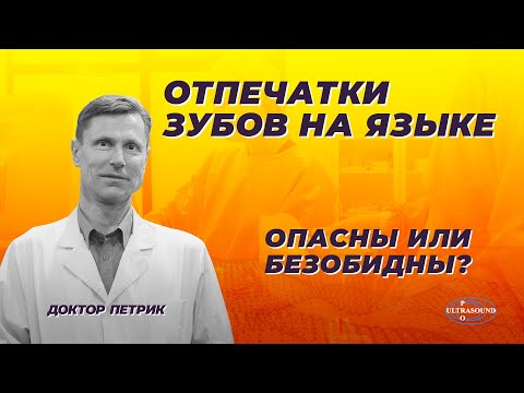 Видео: Отпечатки зубов на языке.Опасны или безобидны.