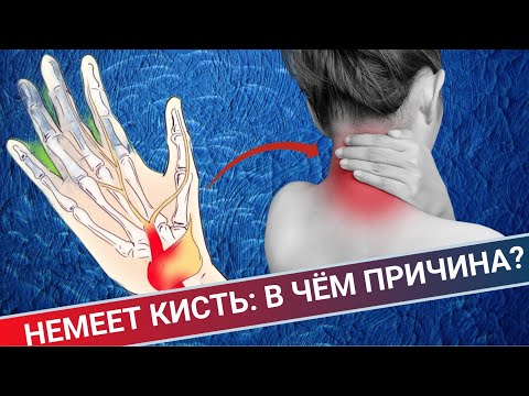 Видео: НЕМЕЕТ КИСТЬ || СРАВНЕНИЕ ДВУХ СЛУЧАЕВ