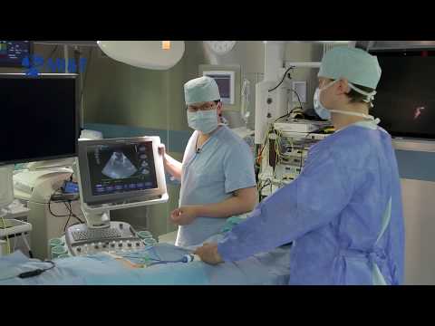 Видео: Сапельников О.В. Крио аблация и РЧА аблация. Два в одном.