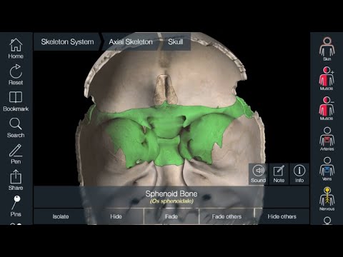 Видео: Феномен (синдром) пустого турецкого седла