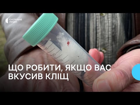 Видео: Що робити, якщо вас вкусив кліщ: поради волинського епідеміолога