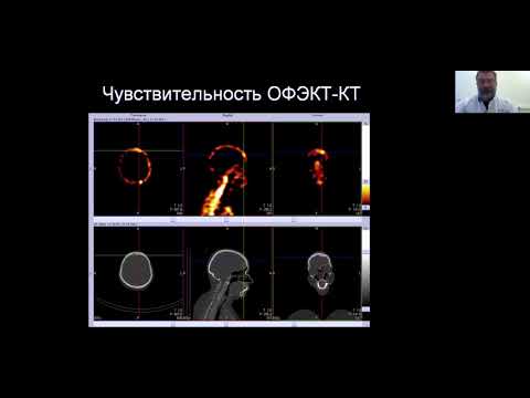 Видео: Сухов В.Ю. ОФЭКТ/КT современный бренд клинической ядерной медицины