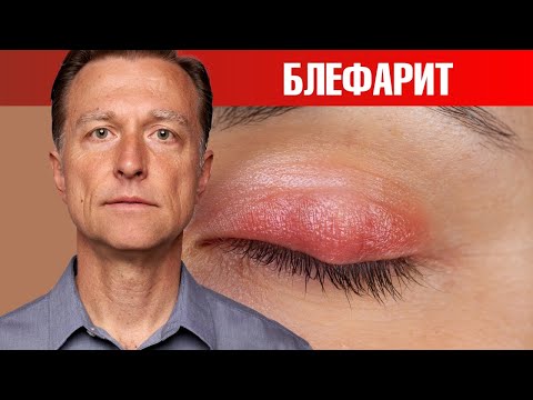 Видео: Натуральное средство от воспаления век. 100% эффективно 🙌