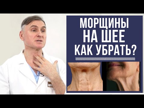 Видео: КАК УБРАТЬ МОРЩИНЫ НА ШЕЕ?  ПОДТЯЖКА ШЕИ ПРИ КОЛЬЦАХ «ВЕНЕРЫ», ТЯЖАХ