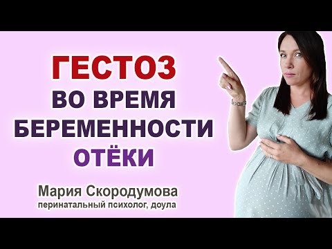 Видео: Почему опасен ГЕСТОЗ? Отеки при беременности.