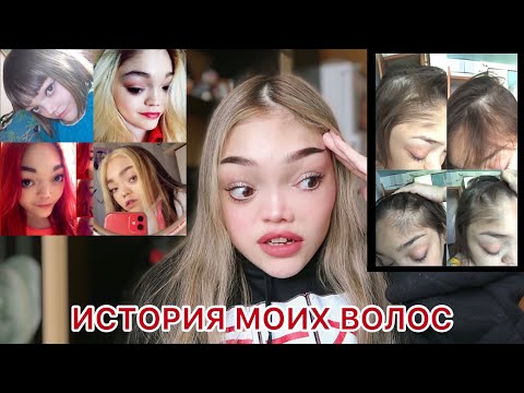 Видео: ИСТОРИЯ МОИХ ВОЛОС или КАК Я НЕ ОСТАЛАСЬ ЛЫСОЙ