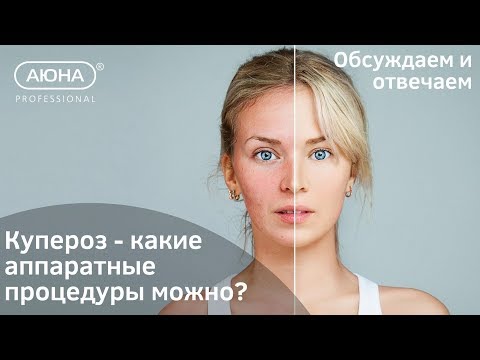 Видео: КУПЕРОЗ и аппаратные процедуры: что можно и что нельзя?