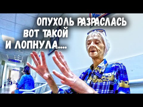 Видео: У ЖЕНЩИНЫ РАК 4 СТАДИИ.| Плохие новости | помощь людям.