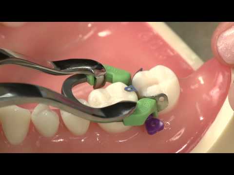 Видео: Демонстрационная версия системы Triodent V3 Matrix с двухлетней гарантией