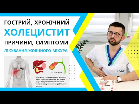 Видео: Холецистит: симптоми, лікування і причини холециститу. Гострий та хронічний холецистит