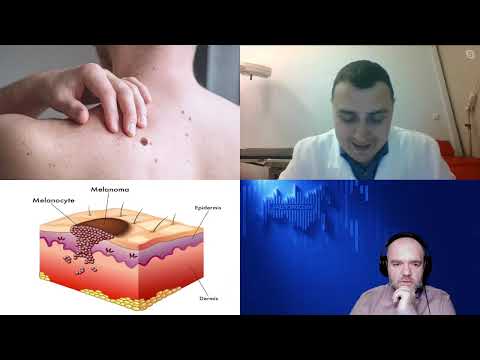 Видео: 1404. И.В. Самойленко: Меланома. Как уберечься и распознать рак кожи