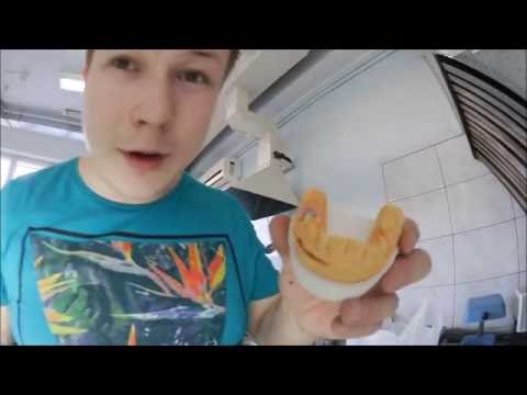 Видео: ВЛОГ: Литьё коронок. Моя работа в стоматологии.