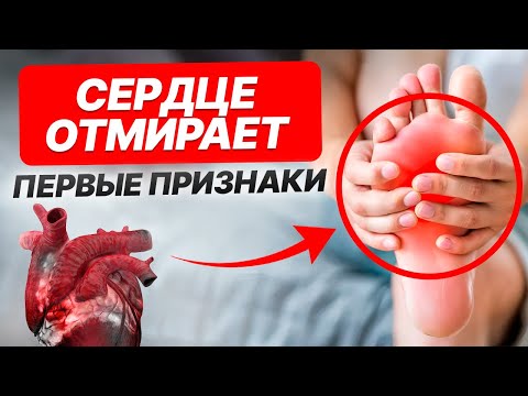 Видео: 5 симптомов, которые КРИЧАТ о проблемах с сосудами! / Почему такая тяжесть в ногах?