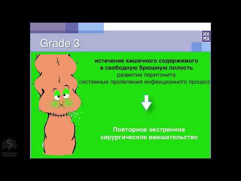 Видео: Лечение несостоятельностей колоректальных анастомозов