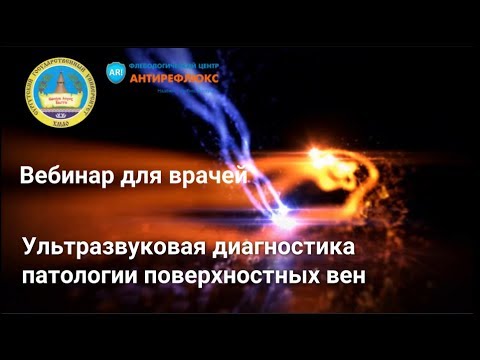 Видео: Вебинар для врачей Ультразвуковая диагностика патологии поверхностных вен