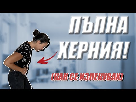 Видео: Моят опит с пъпната херния! Как се излекувах.