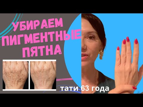 Видео: Убираем пигментные пятна на руках. Лайфхаки по уходу за руками в конце