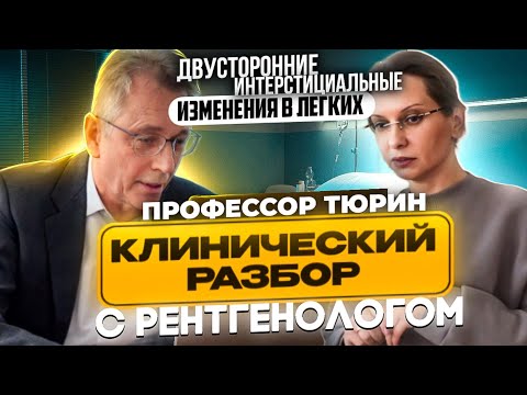 Видео: Клинические разборы с рентгенологом. Профессор Тюрин. Двусторонние интерстициальные изменения.