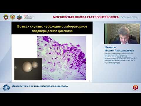 Видео: Шевяков М.А. Диагностика и лечение кандидоза пищевода