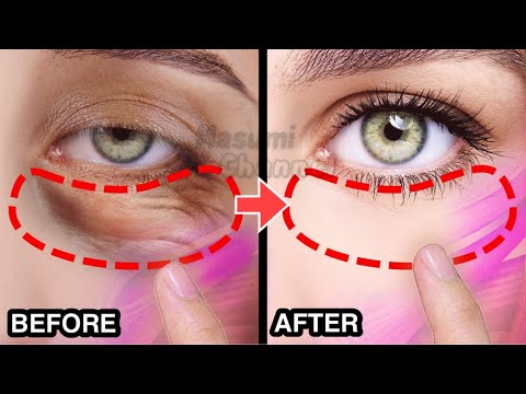 Видео: ЛУЧШЕЕ 8-минутное упражнение для лифтинга глаз от мешков под глазами и темных кругов под глазами🔥