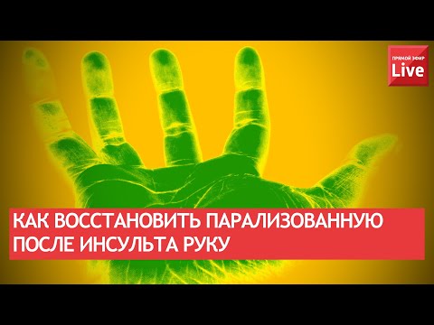 Видео: КАК ВОССТАНОВИТЬ ПАРАЛИЗОВАННУЮ ПОСЛЕ ИНСУЛЬТА РУКУ?