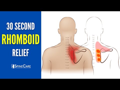Видео: 30-СЕКУНДНОЕ РЕШЕНИЕ: Мгновенное облегчение боли в ромбовидной мышце