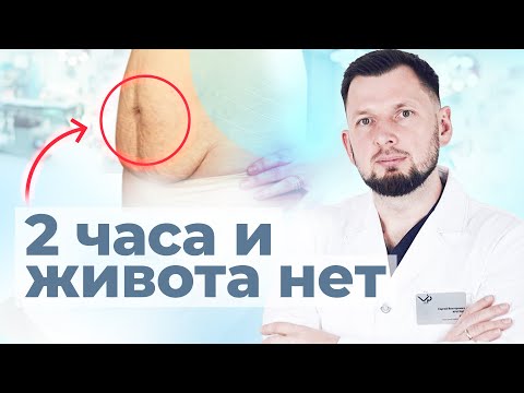 Видео: Абдоминопластика: вся правда от А до Я