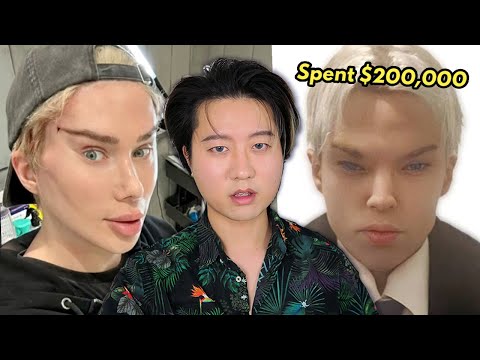 Видео: Подражатель пластической хирургии Оли Лондона