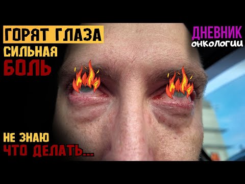 Видео: Обострение. Сильно горят глаза. Что делать не знаю. Сильная боль. Жизнь в диагнозе. Рак крови. Онко