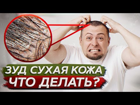 Видео: Как ИЗБАВИТЬСЯ от ЗУДА и СУХОСТИ кожи головы? / Основные средства и способ их применения