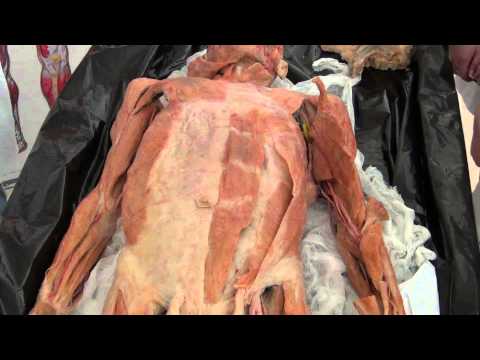 Видео: Мышцы живота и паховый канал на трупе