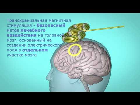 Видео: Транскраниальная магнитная стимуляция (ТМС) в клинике Neurolab