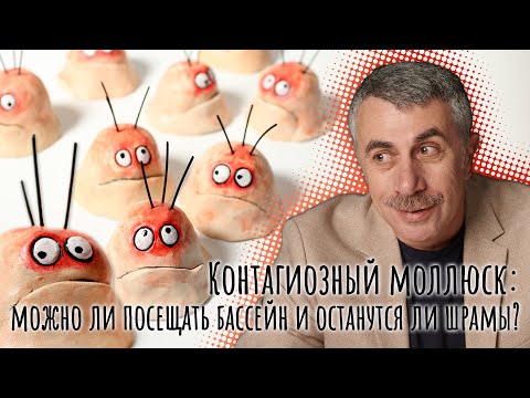 Видео: Контагиозный моллюск: можно ли посещать бассейн и останутся ли шрамы? - Доктор Комаровский