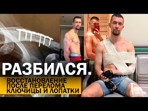 Видео: ПЕРЕЛОМ КЛЮЧИЦЫ и ЛОПАТКИ. Разбился на дороге. Восстановление, с чего начинать?