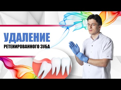 Видео: удаление ретенированного зуба