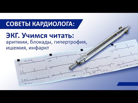 Видео: Советы кардиолога: ЭКГ. Учимся читать