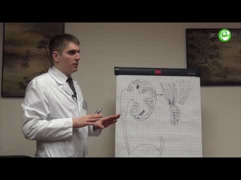 Видео: Почки+камни=мочекаменная болезнь.