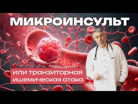 Видео: Микроинсульт или транзиторная ишемическая атака