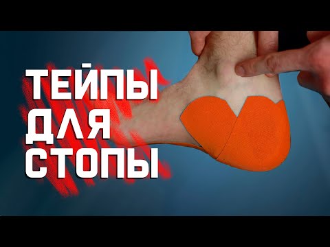 Видео: Как затейпировать плантарный фасциит (пяточную шпору) самому себе?