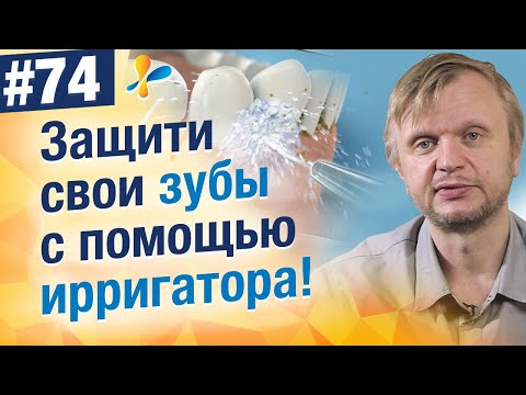 Видео: Вся правда об ирригаторах. Кровоточат десна, вылетают пломбы, чистка брекетов, можно ли детям?