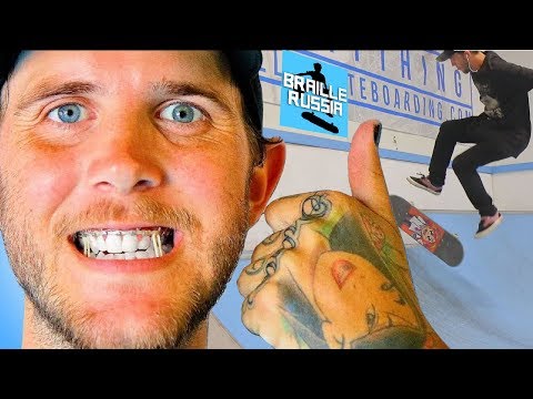 Видео: Фэтти впервые катается после перелома челюсти