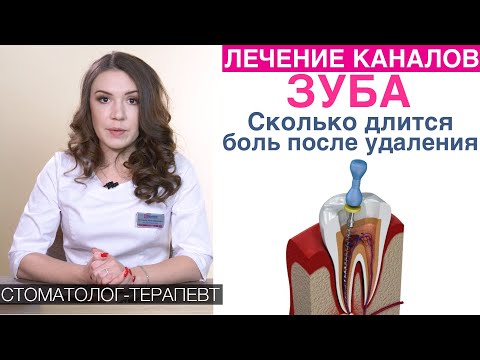 Видео: Лечение каналов зуба - длительность лечения, боль после удаления нерва зуба, срок службы