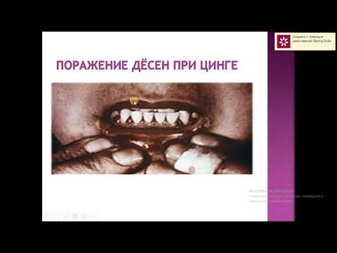 Видео: Биохимия тканей зуба и слюны